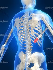 Своевременная терапия остеопороза - залог здоровых костей