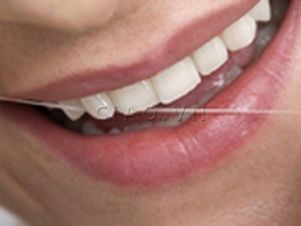 Австралийские стоматологи составили «черный список» продуктов питания, портящих зубы