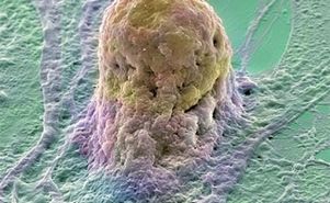 Искусственные стволовые клетки помнят свое прошлое, считают ученые