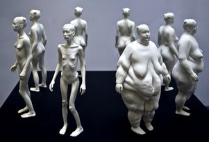 Истощение ведет к ожирению!