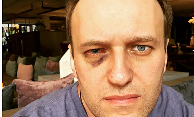 Российского оппозиционера Навального прооперировали в Испании